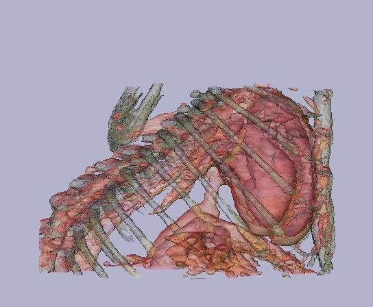 A 3D image obtained from a mouse thorax using a Fenestra contrast agent. (courtesy of JM Mathis, TL Terry, and SC Barlow - from LSU health Sciences Center in Shreveport).