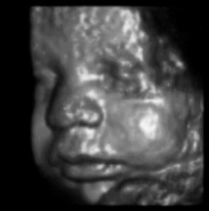 A 3D reconstruction derived from multiple 2D scans