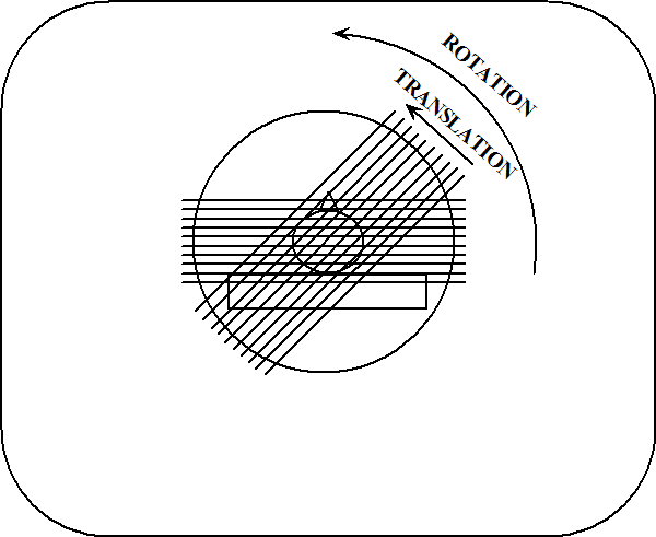 Two x-ray projections taken during a CAT scan.