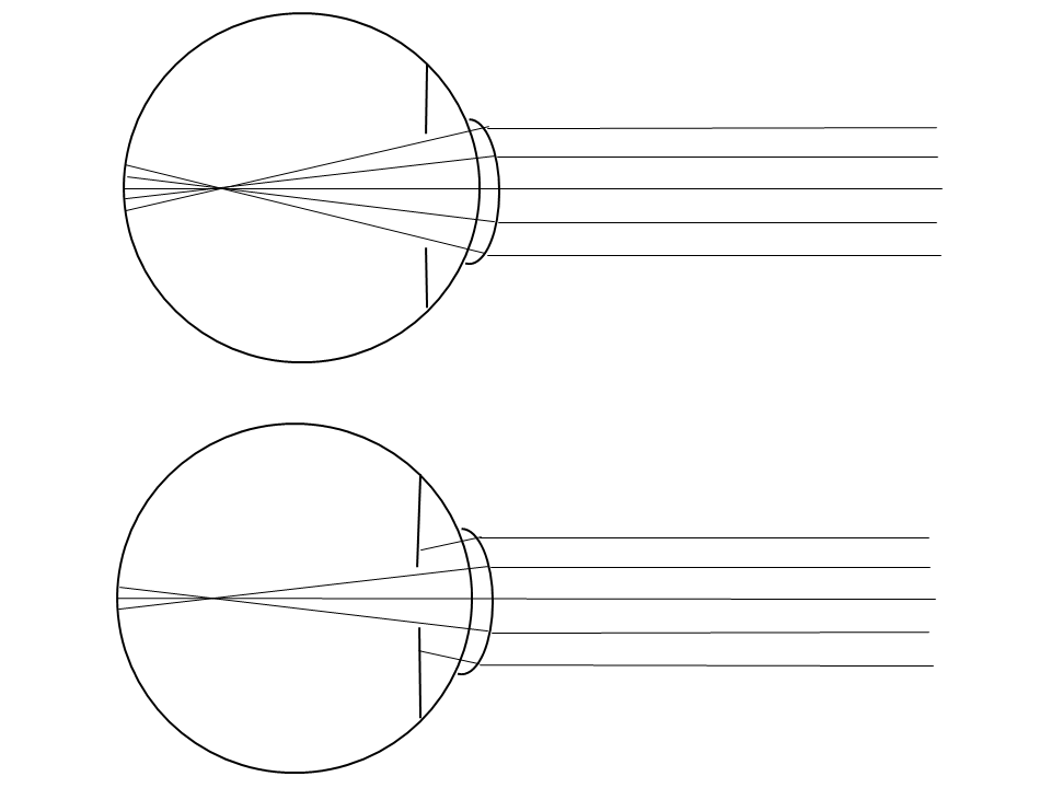 The pupil size affects how clear an image will be.