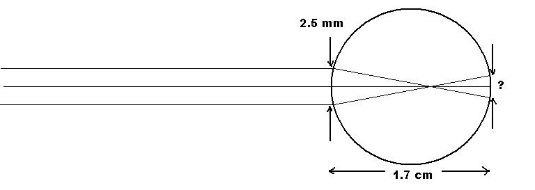 The ray diagram of a near-sighted person when they try to focus on distant objects.